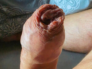 Profile Picture of foreskinplayer